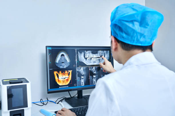 Best Knocked-Out Tooth (Avulsed Tooth) Treatment in Umatilla, OR